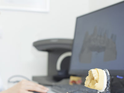 Medit, 3Shape, 3D scanning, dental prosthesis, patent litigation