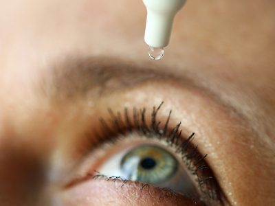 Allergan, Mylan