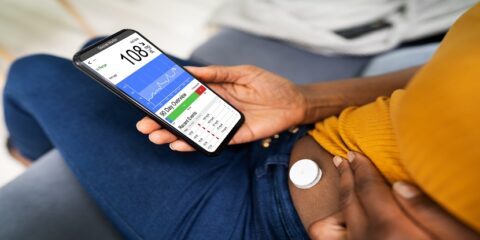Dexcom, Abbott, glucose monitoring devices