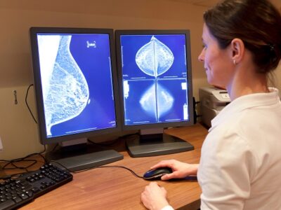 Radiologist looking at mammogram results, everolimus, Novartis, Afinator