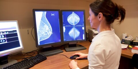 Radiologist looking at mammogram results, everolimus, Novartis, Afinator