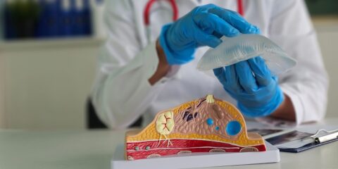 Silimed, Polytech, breast implants