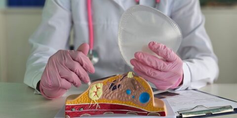 Polytech, Silimed, entitlement action, breast implants