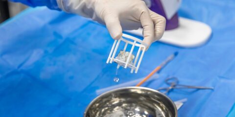 Edwards Lifesciences, Meril Life Science, transcatheter heart valves, EPO Boards of Appeal