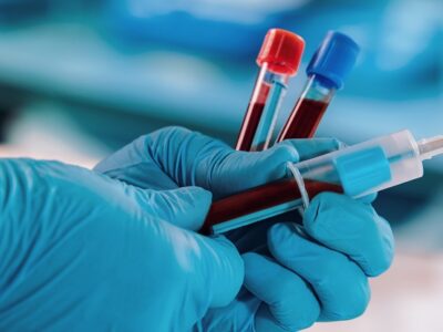 ToolGen, Vertex, CRISPR/Cas, Casgevy, Potter Clarkson, Freshfields