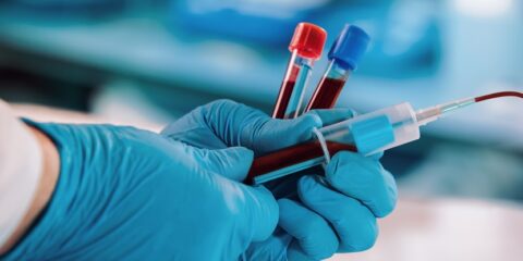ToolGen, Vertex, CRISPR/Cas, Casgevy, Potter Clarkson, Freshfields