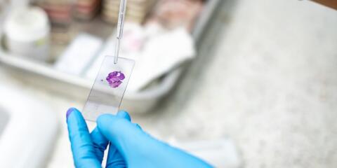 10x Genomics, Curio Bioscience, spatial detection, UPC