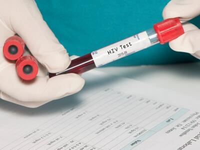 Janssen Pharmaceutica, INPI, HIV, SPCs