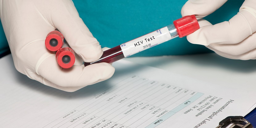 Janssen Pharmaceutica, INPI, HIV, SPCs