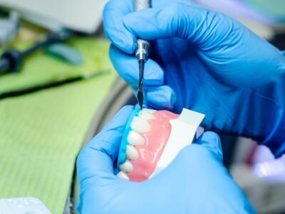 Kettenbach, employee invention, compensation