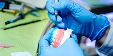 Kettenbach, employee invention, compensation