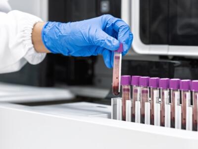 Sophia Genetics, Guardant, Bristows, Carpmaels, liquid biopsy testing,