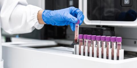 Sophia Genetics, Guardant, Bristows, Carpmaels, liquid biopsy testing,