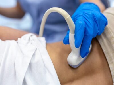 EirGen Pharma, DSM, Rayaldee, calcifediol, EPO, Boards of Appeal