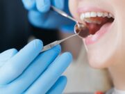 Align, Angelalign, dental
