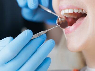 Align, Angelalign, dental