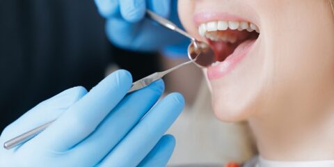 Align, Angelalign, dental
