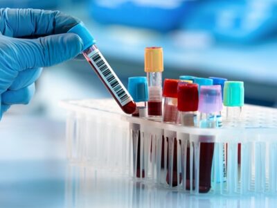 CRISPR, Toolgen, Vertex