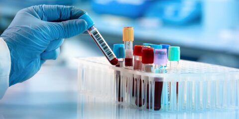 CRISPR, Toolgen, Vertex